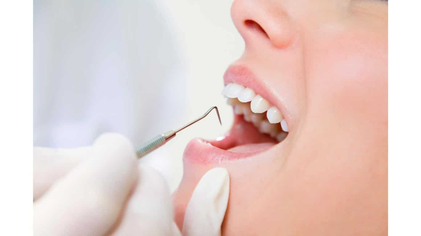 How To Get Nail Glue Off Teeth? 