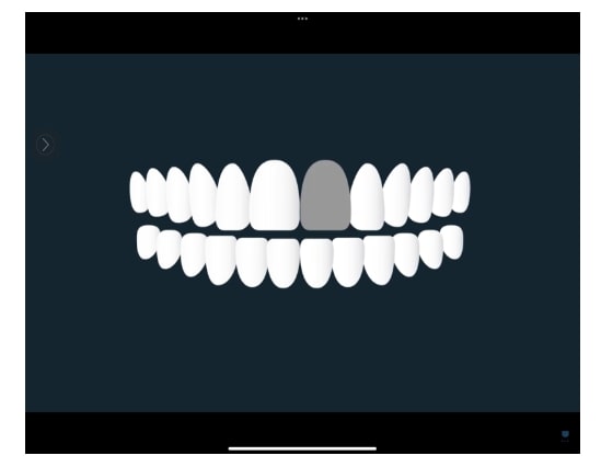 Mechanism of grey teeth occurring